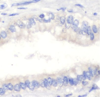 CFHR3 Antibody