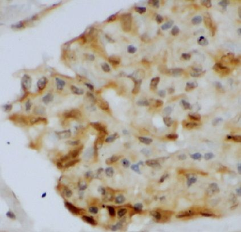 AKR1E2 Antibody