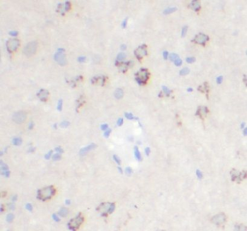 CEP350 Antibody