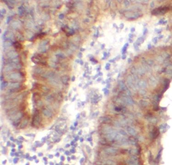 AGO1 Rabbit Polyclonal Antibody