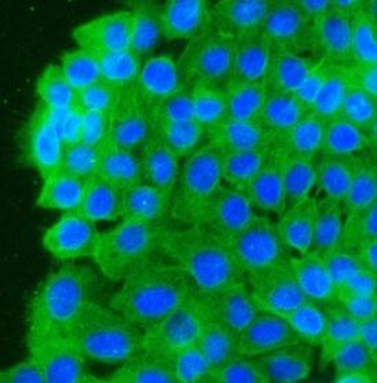 DSG2 Antibody