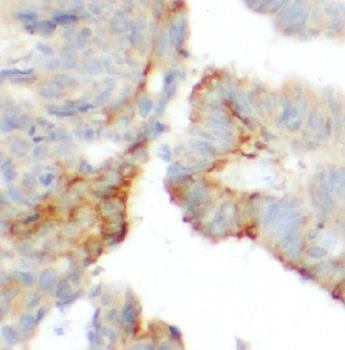 DSG2 Antibody