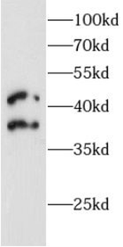 MAF Rabbit Polyclonal Antibody