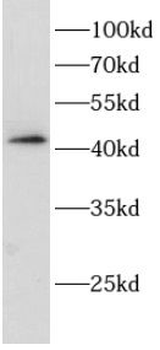 MAGEB18 Rabbit Polyclonal Antibody