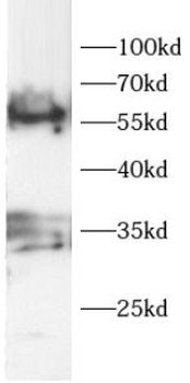 LOX Rabbit Polyclonal Antibody