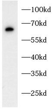 HAVCR2 Rabbit Polyclonal Antibody
