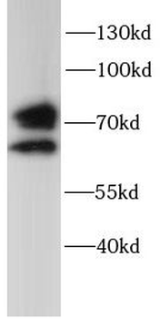 GUSB Rabbit Polyclonal Antibody