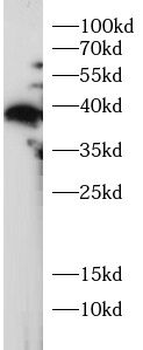 MLF1 Rabbit Polyclonal Antibody
