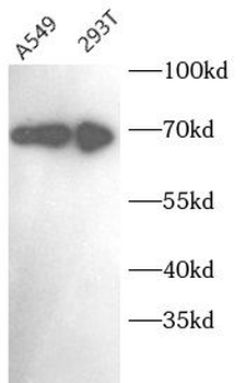 MAGED2 Rabbit Polyclonal Antibody