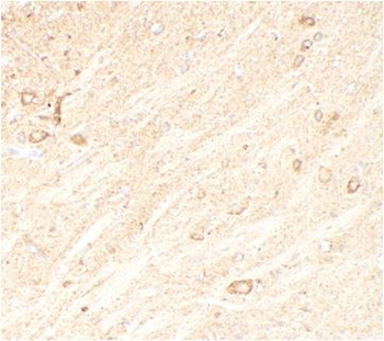 CADM1 Antibody