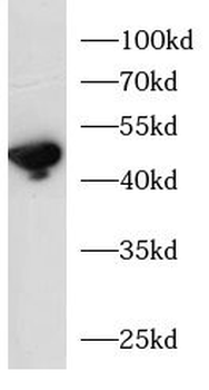 CHGA Rabbit Polyclonal Antibody