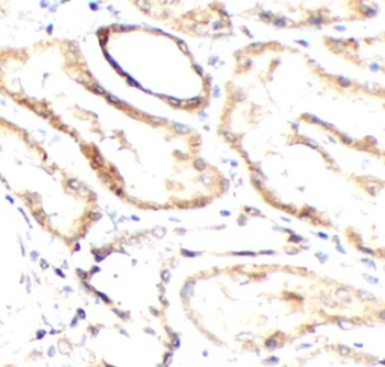CHGA Rabbit Polyclonal Antibody