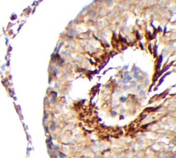 DHH Antibody