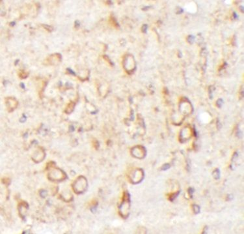 ZNF140 Antibody