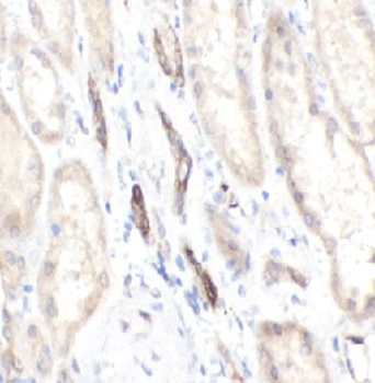 MICB Antibody