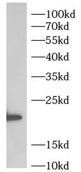 UCK2 Rabbit Polyclonal Antibody