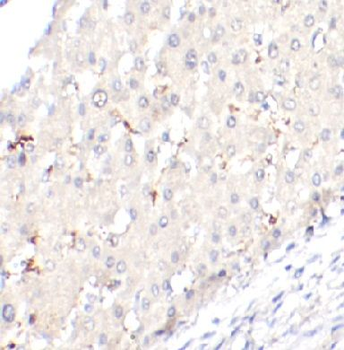 TREM1 Antibody