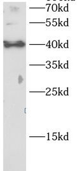 CD79A Rabbit Polyclonal Antibody