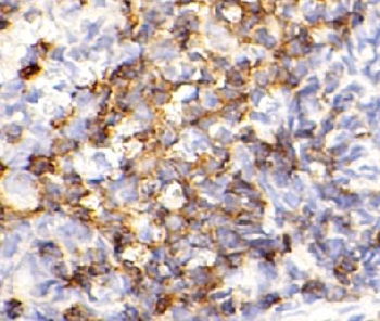 CD79A Rabbit Polyclonal Antibody
