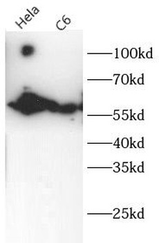 KRT6A Rabbit Polyclonal Antibody