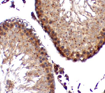 ZNF746 Antibody