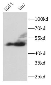 TH Rabbit Polyclonal Antibody