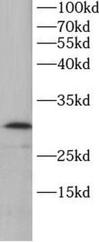 TK1 Antibody