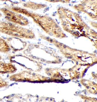 TK1 Antibody