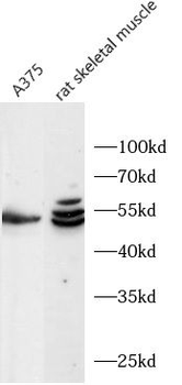 TCF4 Rabbit Polyclonal Antibody