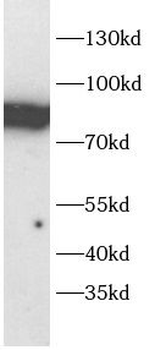 PIK3R1 Rabbit Polyclonal Antibody