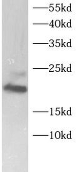 MRPL58 Antibody