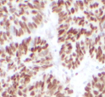 IRF2BP2 Antibody