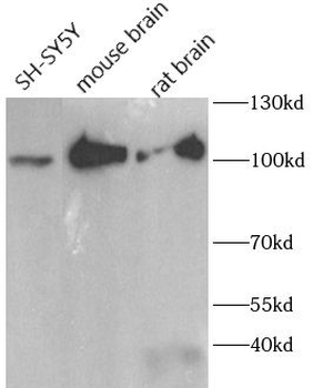 RTN1 A Rabbit Polyclonal Antibody