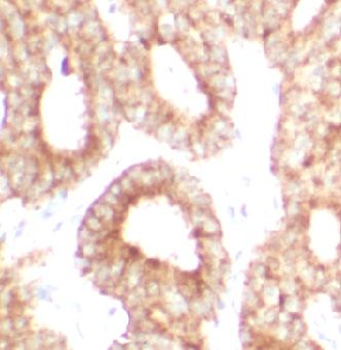 P4HA1 Antibody