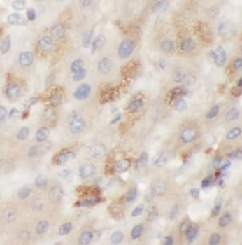 GALC Antibody