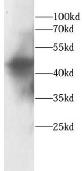 HNF1B Antibody