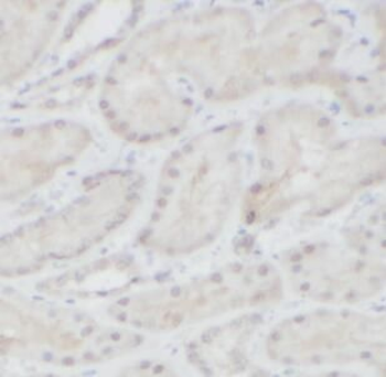 HNF1B Antibody