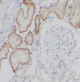 CYP24A1 Antibody
