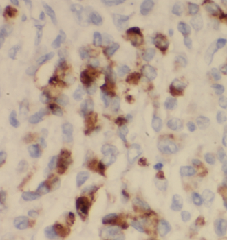 CTSE Antibody