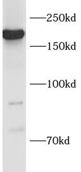 NES Rabbit Polyclonal Antibody