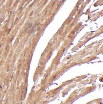 SCN7A Antibody