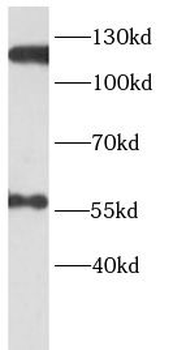 ERCC4 Rabbit Polyclonal Antibody