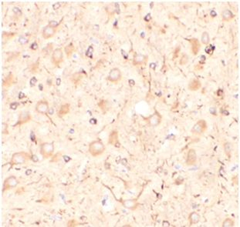 KISS1 Rabbit Polyclonal Antibody