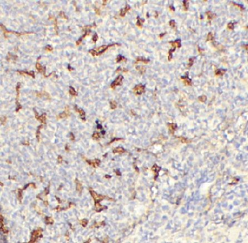 TNFRSF11B Rabbit Polyclonal Antibody