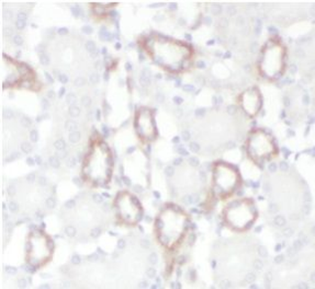 LRRK2 Antibody