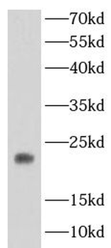 FTH1 Rabbit Polyclonal Antibody