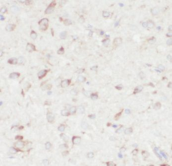 TMEM119 Antibody