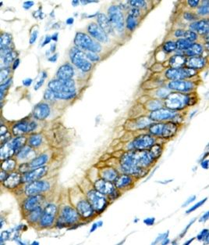 LILRB4 Antibody