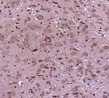TNFRSF25 Antibody