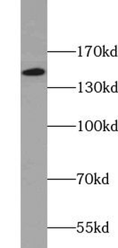 DSG1 Rabbit Polyclonal Antibody